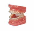 Купить paro® Демонстраційна модель зубів із брекетами