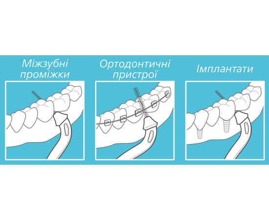 paro® slider Змінні міжзубні щітки smart-sticks, розмір XS/S, 12 шт., зображення 3