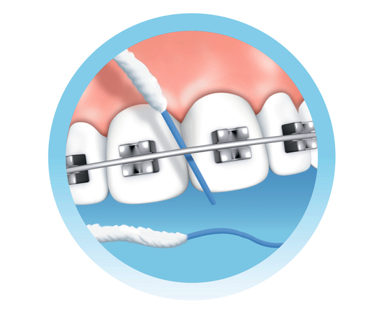 TRISA Expert Floss Зубной флосс для брекетов, мостов, имплантатов и широких межзубных промежутков, с мятой, 30 м, изображение 3