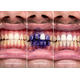 SmileKit V34 Корректор цвета зубов, 30 мл, изображение 9